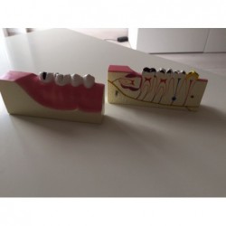 Model demonstracyjny zębów trzonowych