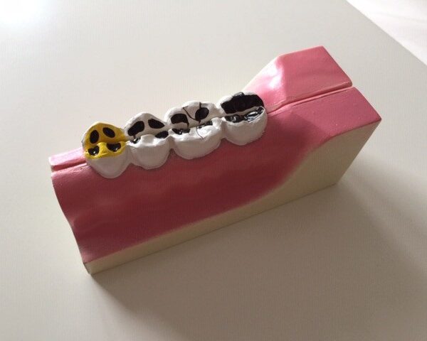 Model demonstracyjny zębów trzonowych