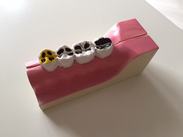 Model demonstracyjny zębów trzonowych