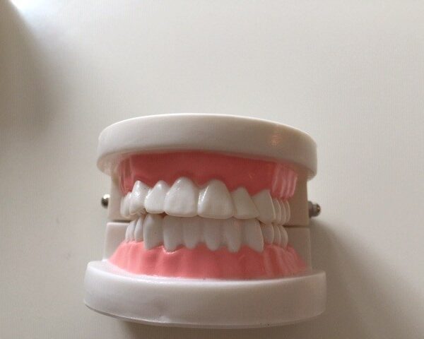 Model szczęki/ zębów